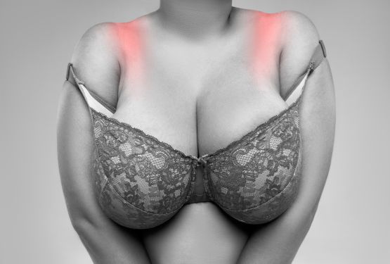 Breast reduction surgery. 
