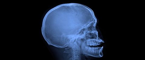 Рак головного мозга: симптомы, диагностика и лечение