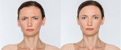 Facial rejuvenation and Facelift
